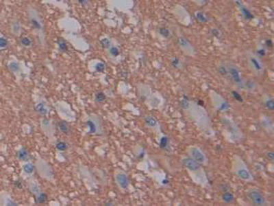 Immunohistochemistry (Formalin/PFA-fixed paraffin-embedded sections) - Anti-GAP43 antibody (AB232772)