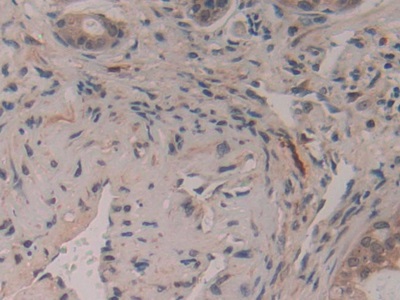 Immunohistochemistry (Formalin/PFA-fixed paraffin-embedded sections) - Anti-GAP43 antibody (AB232772), expandable thumbnail
