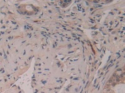 Immunohistochemistry (Formalin/PFA-fixed paraffin-embedded sections) - Anti-GAP43 antibody (AB232772)