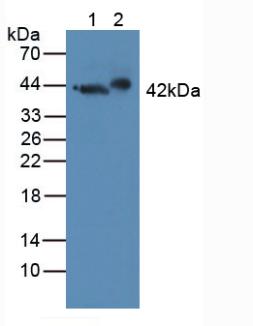 Western blot - Anti-GAP43 antibody (ab232772), expandable thumbnail