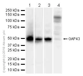 Western blot - Anti-GAP43 antibody [EP890Y] - Neuronal Marker (AB75810)