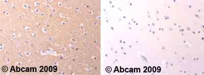 Immunohistochemistry (Formalin/PFA-fixed paraffin-embedded sections) - Anti-GAP43 antibody - Neuronal Marker (AB12274), expandable thumbnail