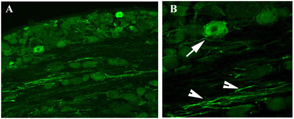 Immunohistochemistry (PFA fixed) - Anti-GAP43 antibody - Neuronal Marker (AB16053), expandable thumbnail