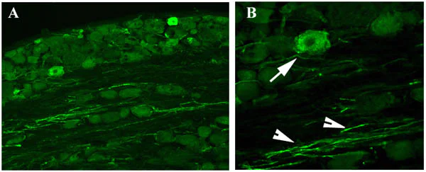 Immunohistochemistry (PFA fixed) - Anti-GAP43 antibody - Neuronal Marker (AB16053)