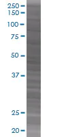 SDS-PAGE - GAP43 overexpression 293T lysate (whole cell) (AB94150)