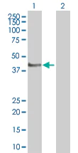 Western blot - GAP43 overexpression 293T lysate (whole cell) (AB94150)