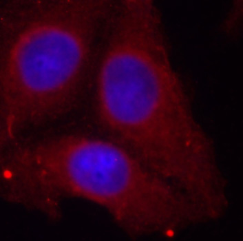 Immunocytochemistry/ Immunofluorescence - Anti-GAP43 (phospho S41) antibody (AB194929), expandable thumbnail