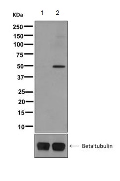 Western blot - Anti-GAP43 (phospho S41) antibody [EPR1854(2)] (AB167162), expandable thumbnail