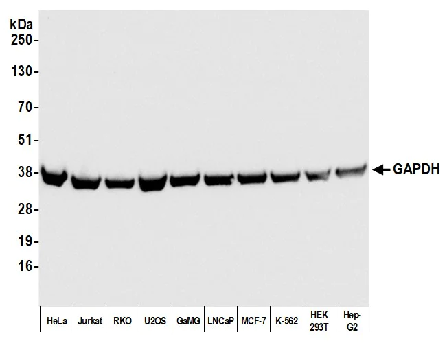 Western blot - Anti-GAPDH antibody [12G11] - Loading Control (AB226408)