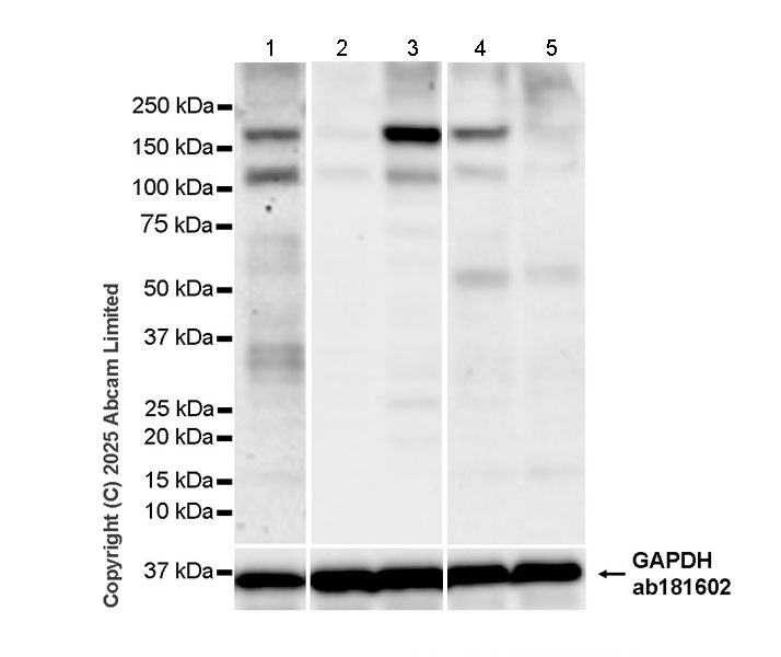 Western blot - Anti-GAPDH antibody [EPR16891] - Loading Control (ab181602), expandable thumbnail