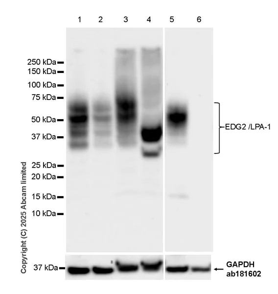 Western blot - Anti-GAPDH antibody [EPR16891] - Loading Control (AB181602)
