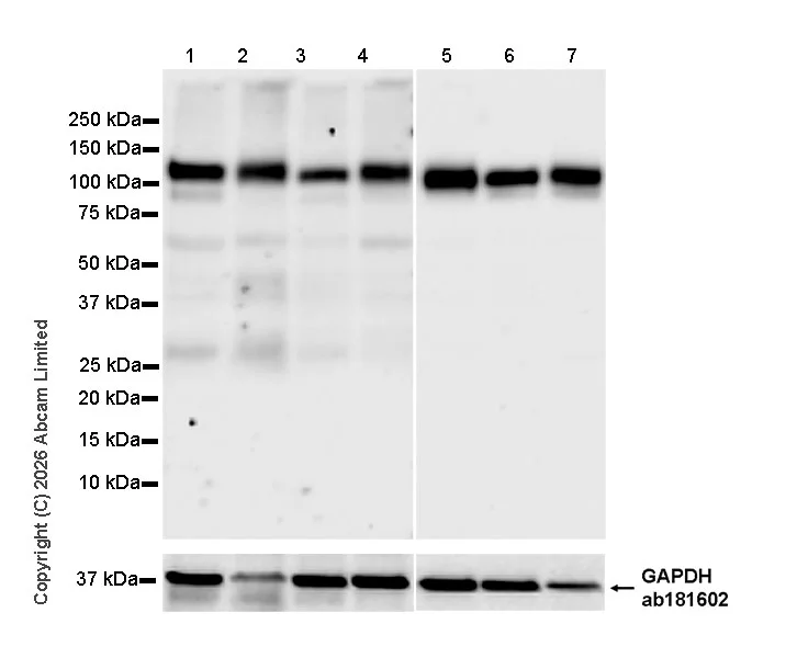 Western blot - Anti-GAPDH antibody [EPR16891] - Loading Control (AB181602)