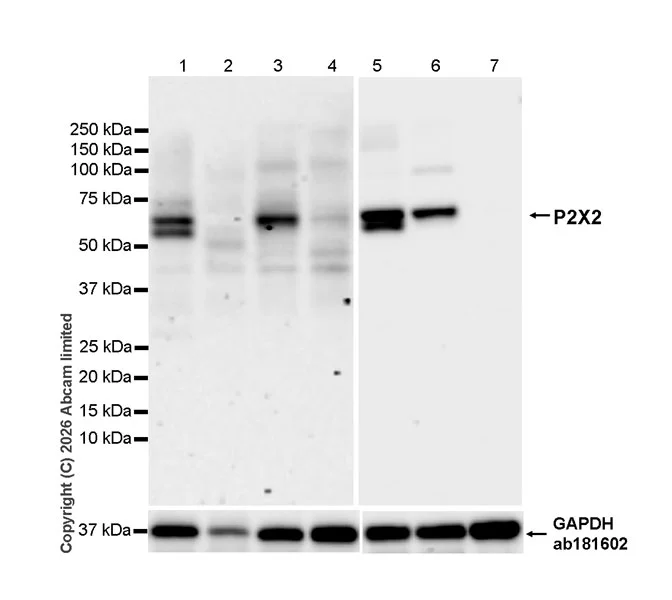 Western blot - Anti-GAPDH antibody [EPR16891] - Loading Control (AB181602)