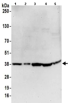 Western blot - Anti-GAPDH antibody - Loading Control (AB157156)