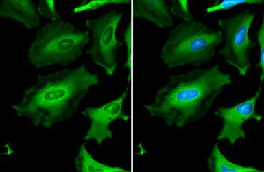 Immunocytochemistry/ Immunofluorescence - Anti-GAPDH antibody - Loading Control (AB210113)