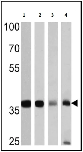 Western blot - Anti-GAPDH antibody - Loading Control (AB22555)