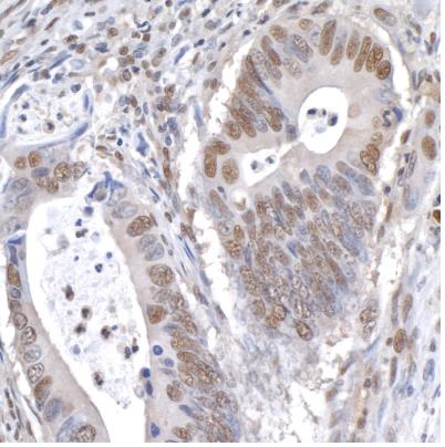 Immunohistochemistry (Formalin/PFA-fixed paraffin-embedded sections) - Anti-GAPDH antibody (AB245355), expandable thumbnail