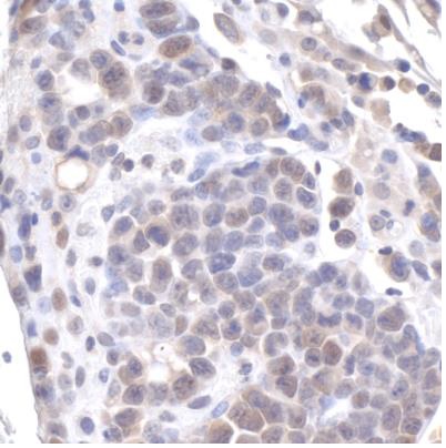 Immunohistochemistry (Formalin/PFA-fixed paraffin-embedded sections) - Anti-GAPDH antibody (AB245355), expandable thumbnail
