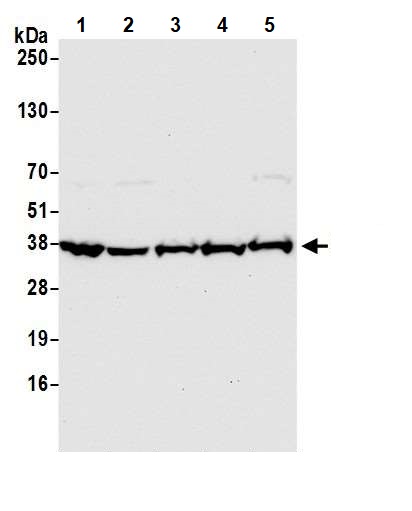 Western blot - Anti-GAPDH antibody - Loading Control (AB245355), expandable thumbnail