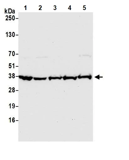 Western blot - Anti-GAPDH antibody - Loading Control (AB245355)