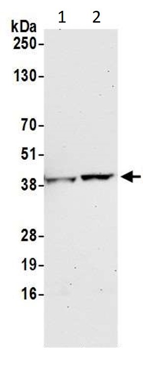 Western blot - Anti-GAPDH antibody - Loading Control (AB245357), expandable thumbnail