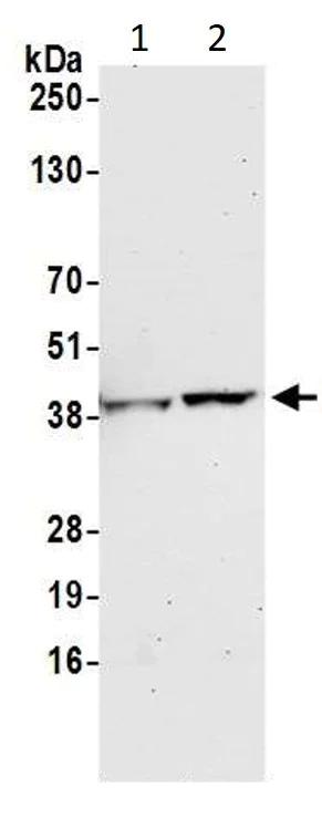 Western blot - Anti-GAPDH antibody - Loading Control (AB245357)