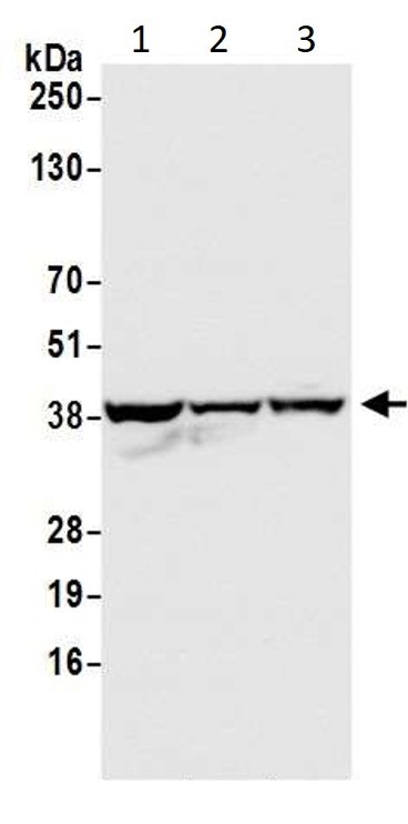 Western blot - Anti-GAPDH antibody - Loading Control (AB245357), expandable thumbnail