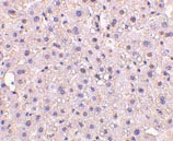 Immunohistochemistry (Formalin/PFA-fixed paraffin-embedded sections) - Anti-GAPDH antibody - Loading Control (AB37168), expandable thumbnail