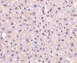 Immunohistochemistry (Formalin/PFA-fixed paraffin-embedded sections) - Anti-GAPDH antibody - Loading Control (AB37168)