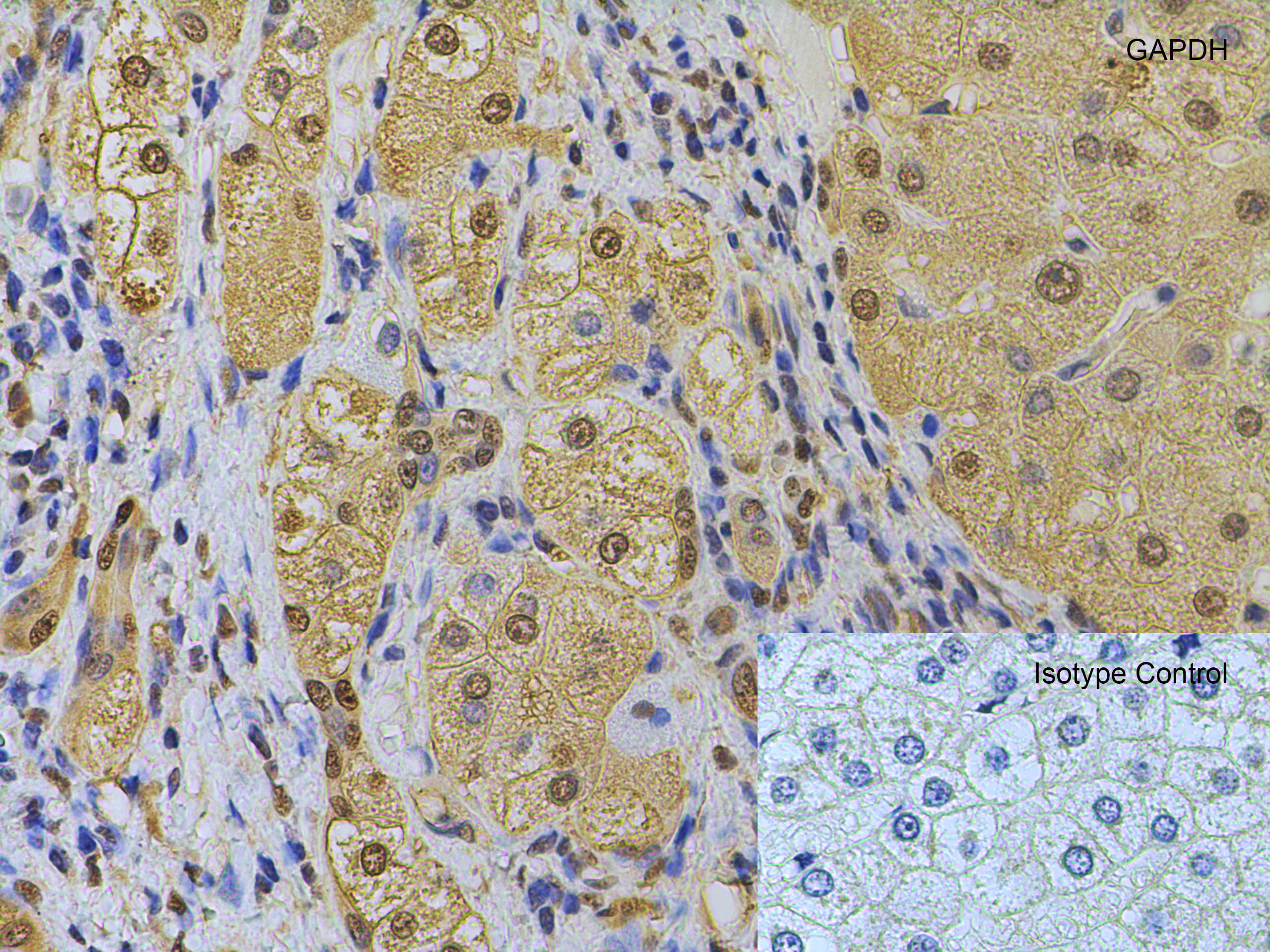 Immunohistochemistry (Formalin/PFA-fixed paraffin-embedded sections) - Anti-GAPDH antibody - Loading Control (ab37168), expandable thumbnail