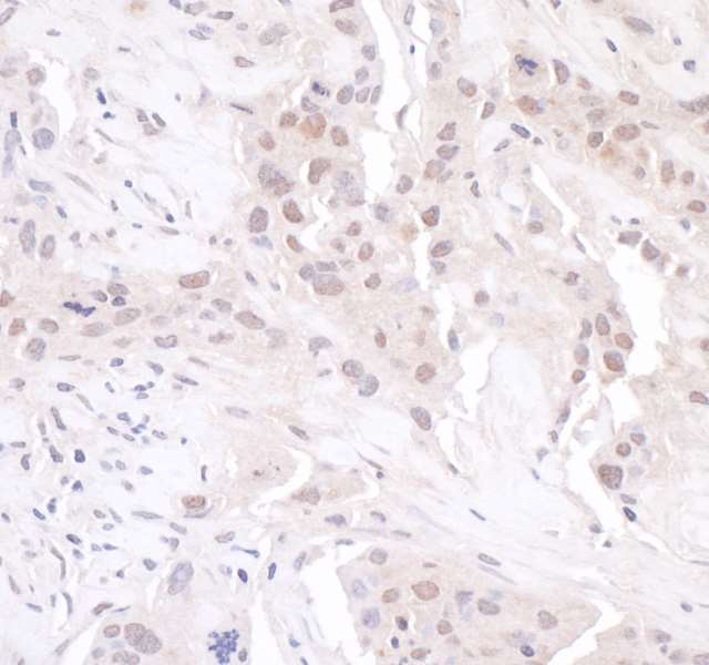 Immunohistochemistry (Formalin/PFA-fixed paraffin-embedded sections) - Anti-GAPDH antibody - Loading Control (AB70699), expandable thumbnail
