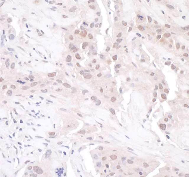 Immunohistochemistry (Formalin/PFA-fixed paraffin-embedded sections) - Anti-GAPDH antibody - Loading Control (AB70699)