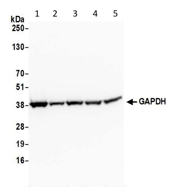 Western blot - Anti-GAPDH antibody - Loading Control (AB70699), expandable thumbnail
