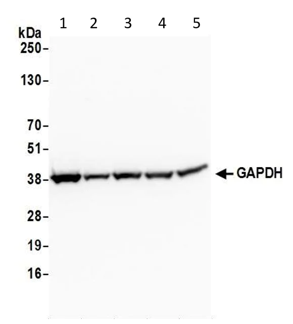 Western blot - Anti-GAPDH antibody - Loading Control (AB70699)