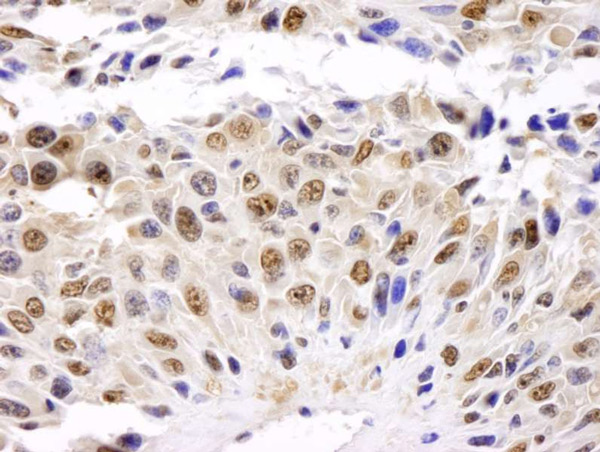 Immunohistochemistry (Formalin/PFA-fixed paraffin-embedded sections) - Anti-GAPDH antibody - Loading Control (AB70700), expandable thumbnail