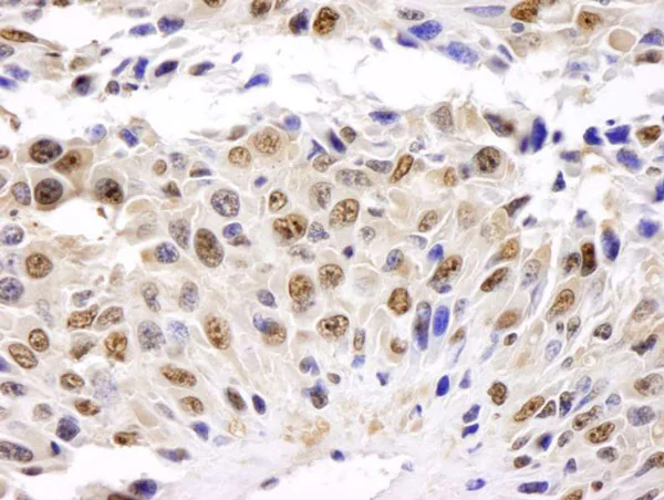 Immunohistochemistry (Formalin/PFA-fixed paraffin-embedded sections) - Anti-GAPDH antibody - Loading Control (AB70700)