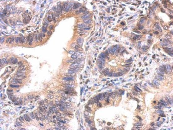 Immunohistochemistry (Formalin/PFA-fixed paraffin-embedded sections) - Anti-GAPDS antibody (AB153802), expandable thumbnail