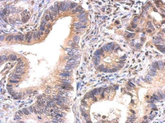 Immunohistochemistry (Formalin/PFA-fixed paraffin-embedded sections) - Anti-GAPDS antibody (AB153802)