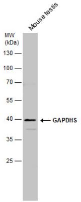Western blot - Anti-GAPDS antibody (AB153802), expandable thumbnail