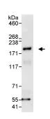 Immunoprecipitation - Anti-GAPex 5 antibody (AB86033)