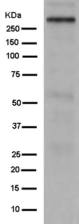 Western blot - Anti-GARNL1 antibody [EPR13592-38] (AB182570)
