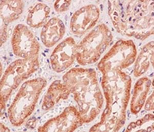 Immunohistochemistry (Formalin/PFA-fixed paraffin-embedded sections) - Anti-GARNL1 antibody [EPR13592-38] - BSA and Azide free (AB250623), expandable thumbnail