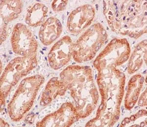 Immunohistochemistry (Formalin/PFA-fixed paraffin-embedded sections) - Anti-GARNL1 antibody [EPR13592-38] - BSA and Azide free (AB250623)