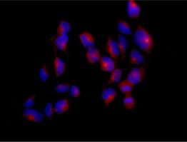 Immunocytochemistry/ Immunofluorescence - Anti-GARNL1 antibody [EPR13592] (AB182148)