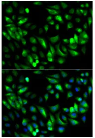 Immunocytochemistry/ Immunofluorescence - Anti-GARS antibody (AB196496)