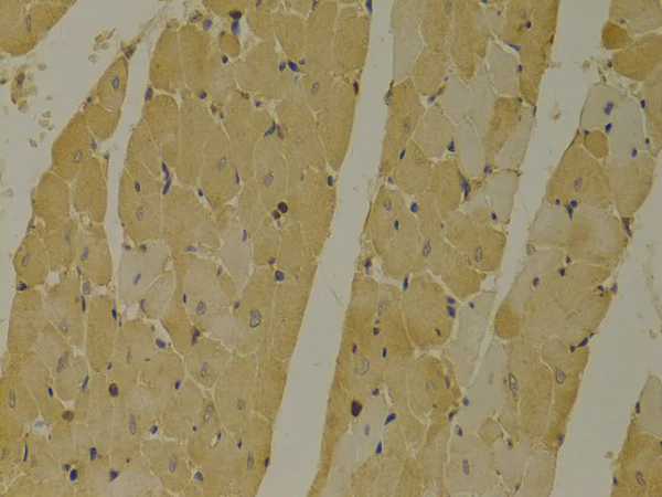 Immunohistochemistry (Formalin/PFA-fixed paraffin-embedded sections) - Anti-GARS antibody (AB196496)