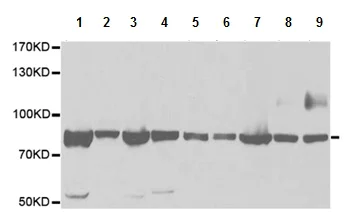 Western blot - Anti-GARS antibody (AB196496)