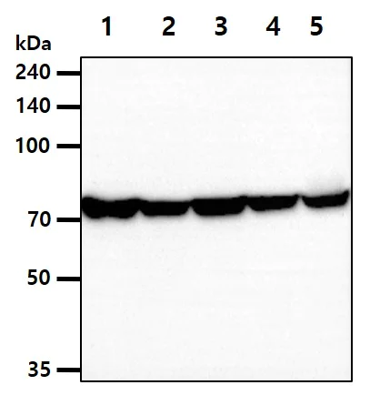 Western blot - Anti-GARS antibody [AT4E10] (AB282154)