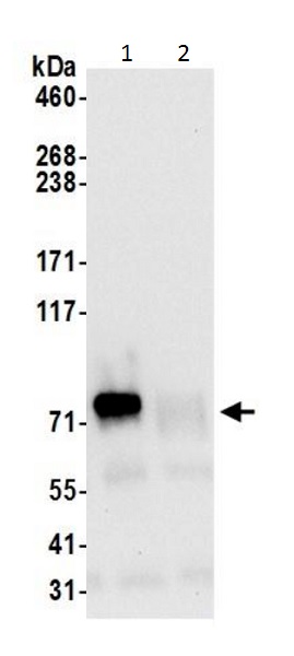 Immunoprecipitation - Anti-GARS antibody - C-terminal (AB226209), expandable thumbnail
