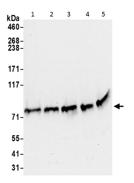 Western blot - Anti-GARS antibody - C-terminal (AB226209), expandable thumbnail